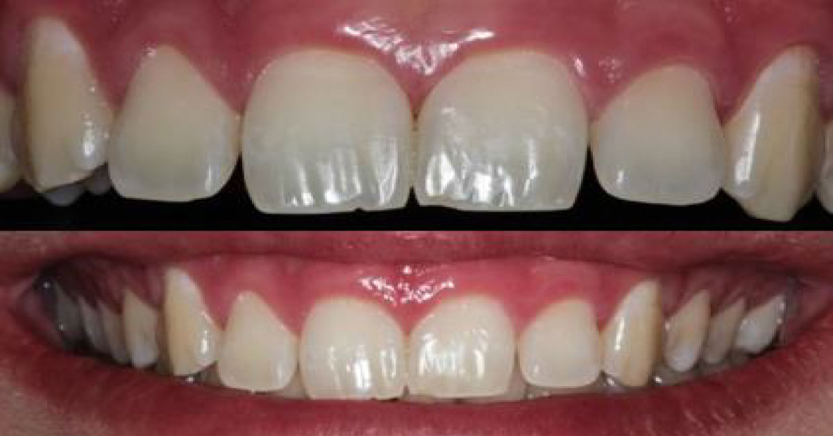 Take A Look At The Young Man’s Dental Exam