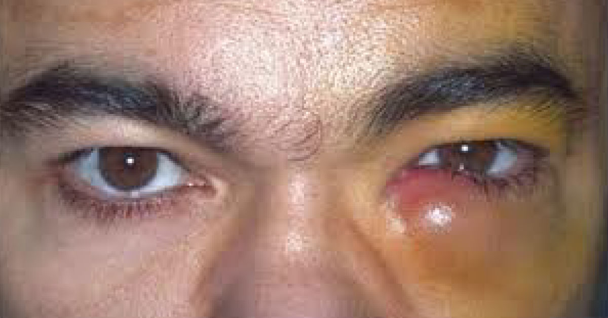 What Is The Diagnosis?