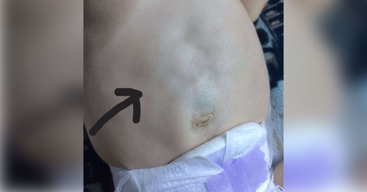 Identify This Rare Disorder
