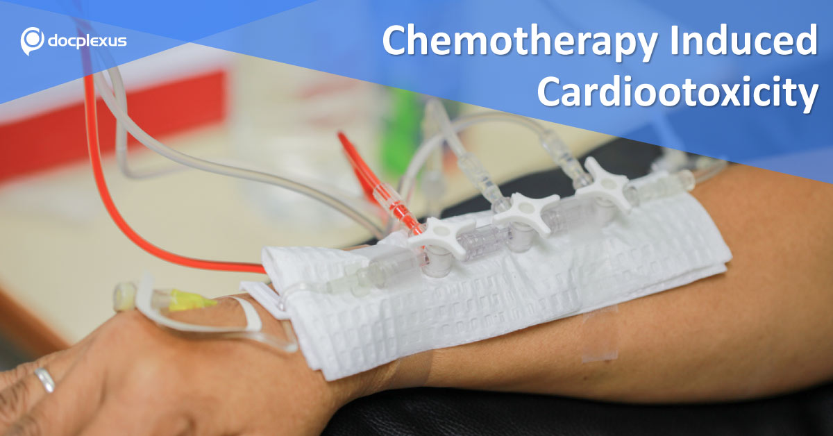 Cardiotoxicity of Chemotherapeutic Agents and Radiotherapy Related Heart Disease: ESMO Clinical Guidelines