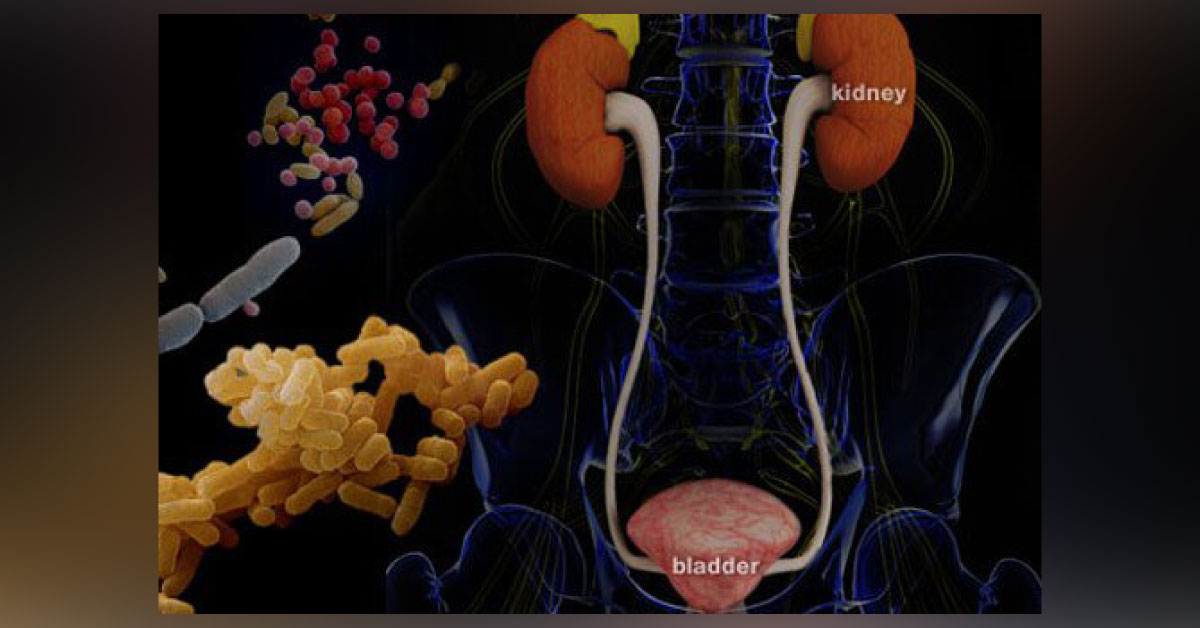 Advances In Diagnosis Of Urinary Tract Infections