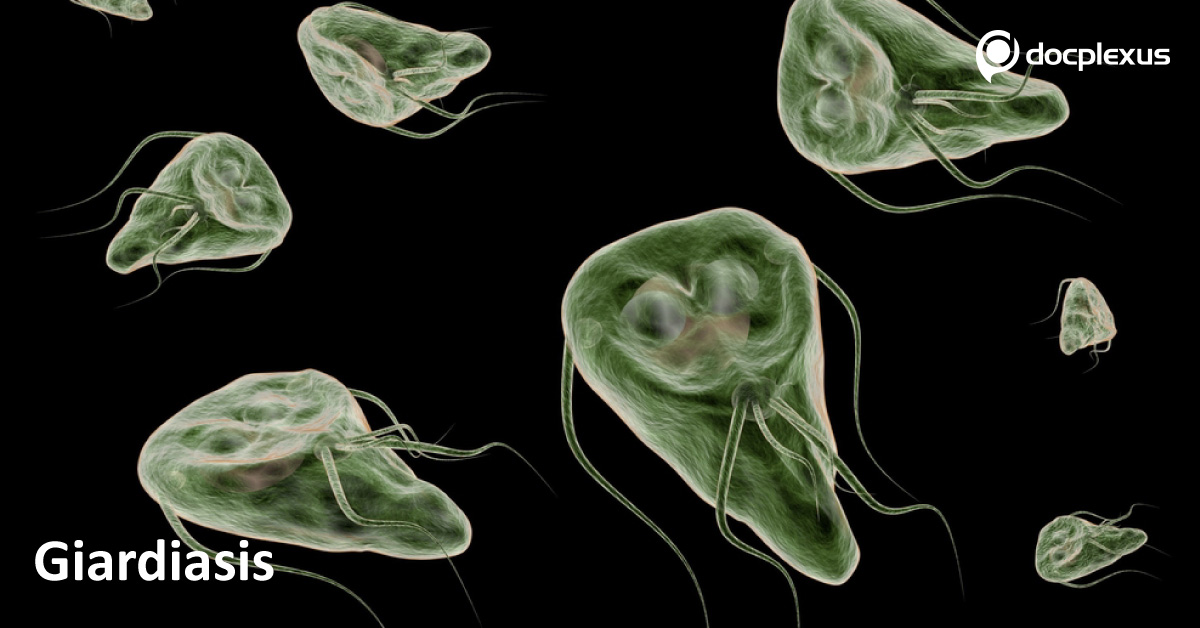 Giardiasis- An Outline And Management