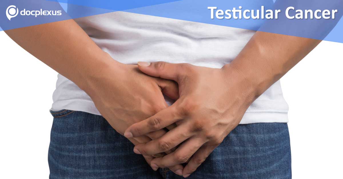 Treatment of Testicular Cancer