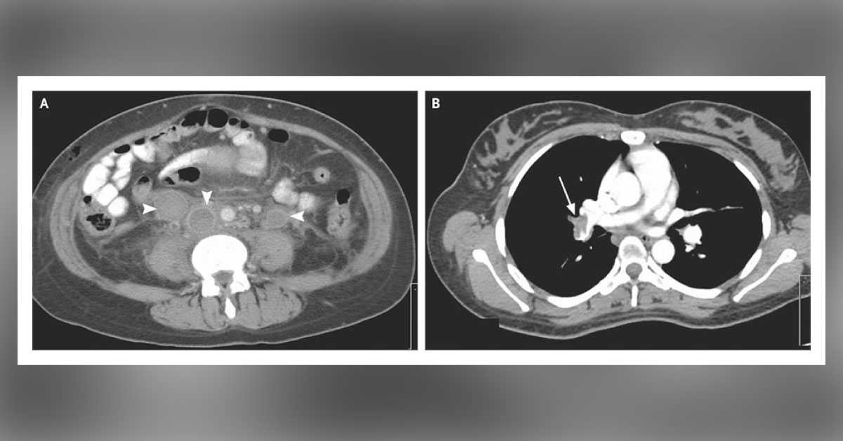 Identify And Suggest Treatment For This Patient