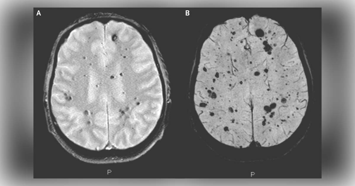 Identify This Patient's Condition Based on the MRI Scans