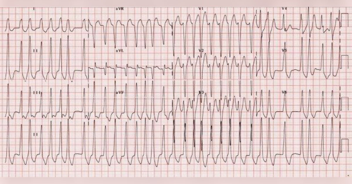Identify This Condition And Suggest Management