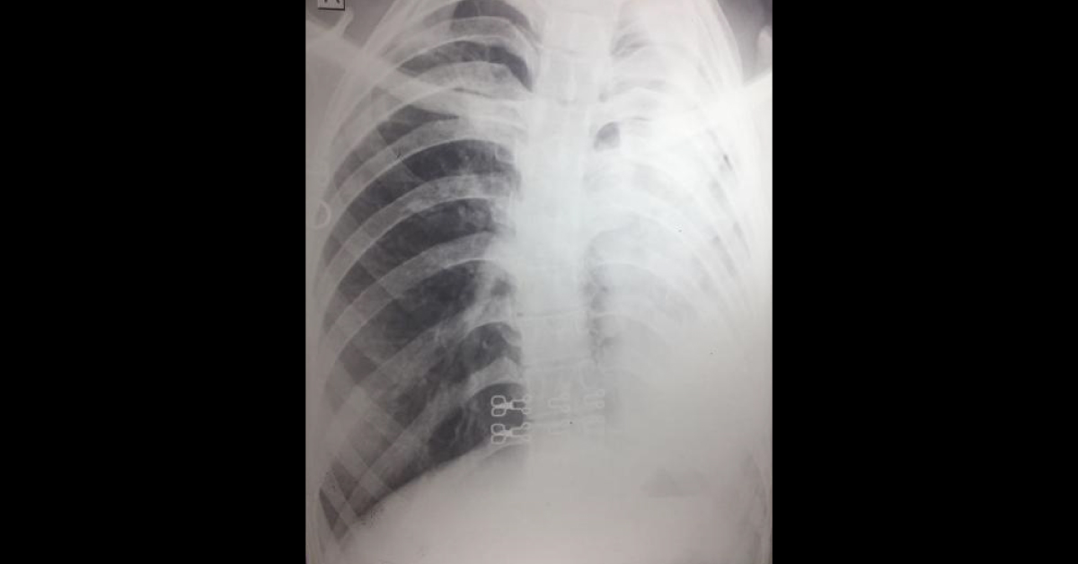 Can This Case Be Of Genetic Disorder?