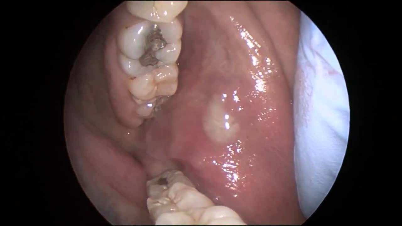 What are the Differential Diagnosis?