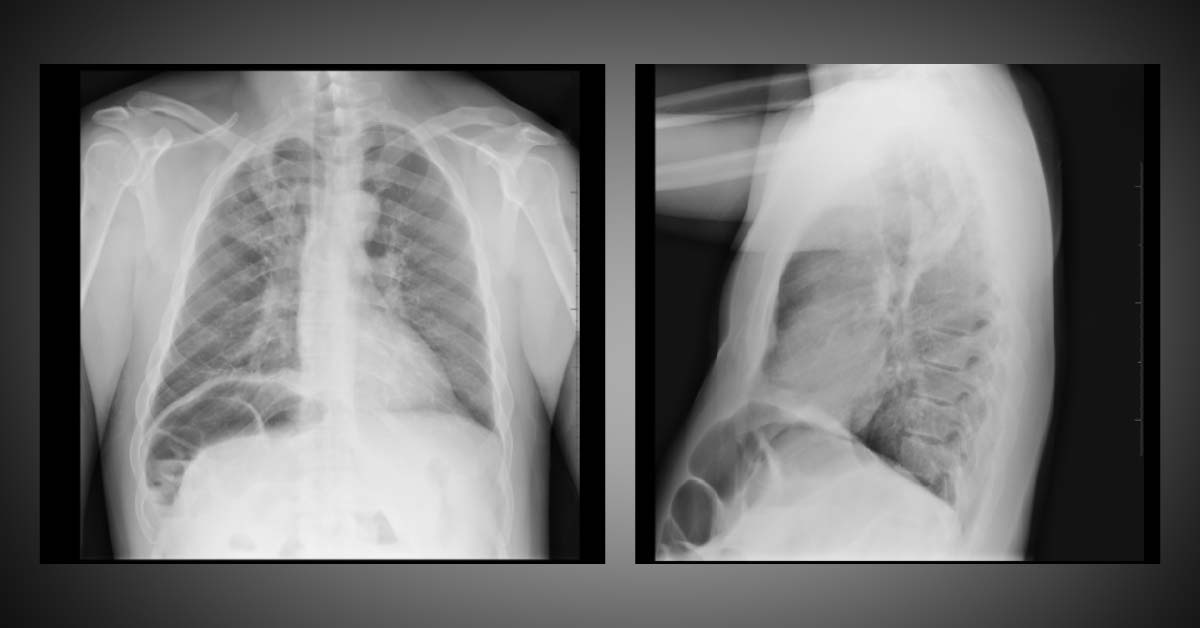 Evaluate The X-Ray Findings
