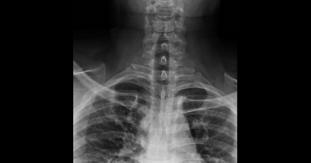 What Does The Radiograph Reveal?