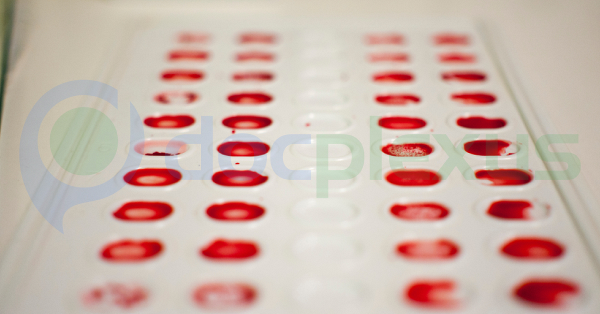 Subgroups And Weaker Variants Of And B Blood Groups And Bombay Phenotype