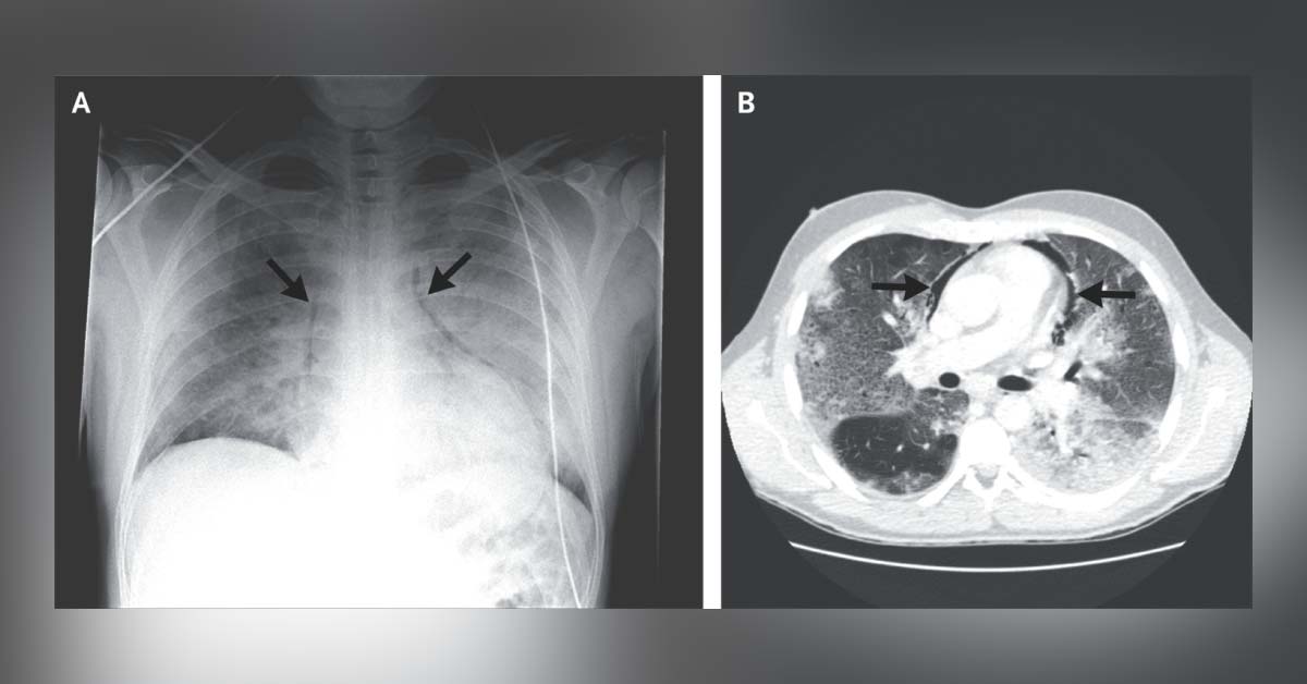 Identify This Condition