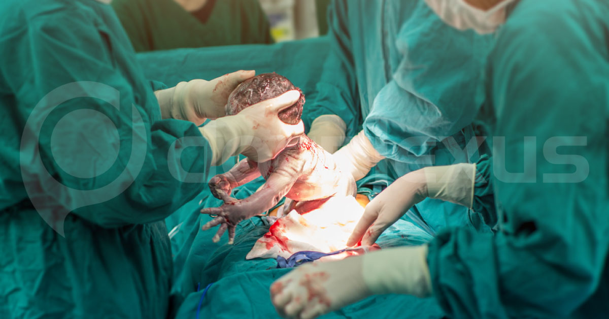 Vaginal Cleansing Before Cesarean Delivery Reduces Incidence Of Infection