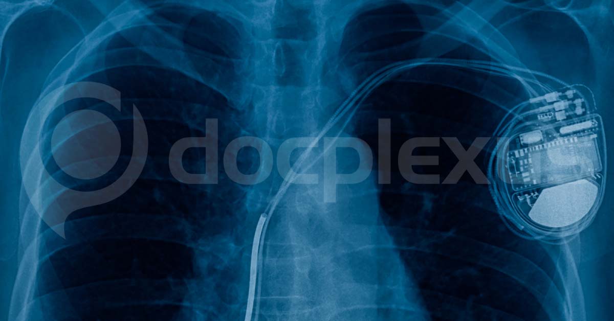 Patients With Older Pacemaker And Defibrillator Can Undergo MRI