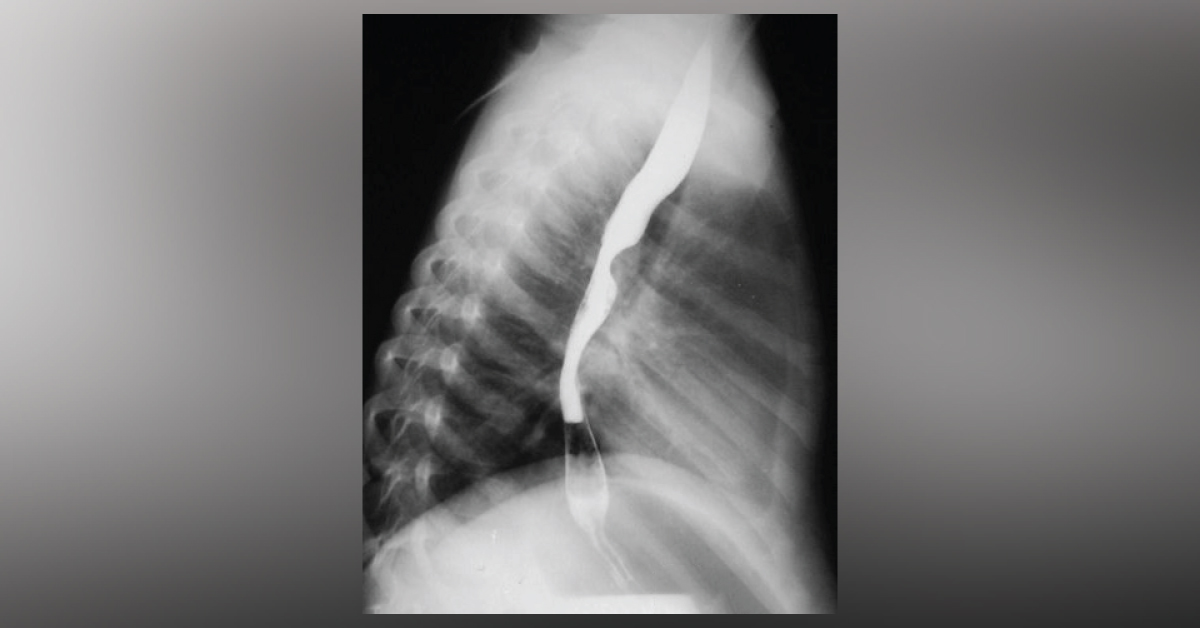 What Is The Diagnosis