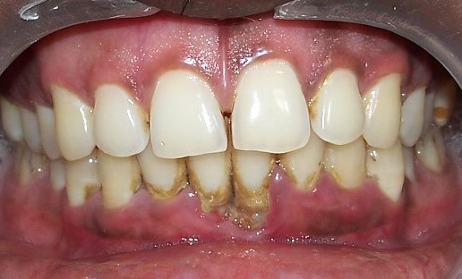 Dental Spot Diagnosis