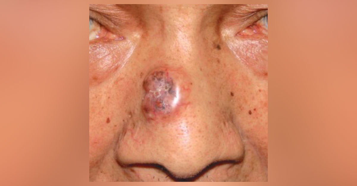 Suggest the Diagnosis