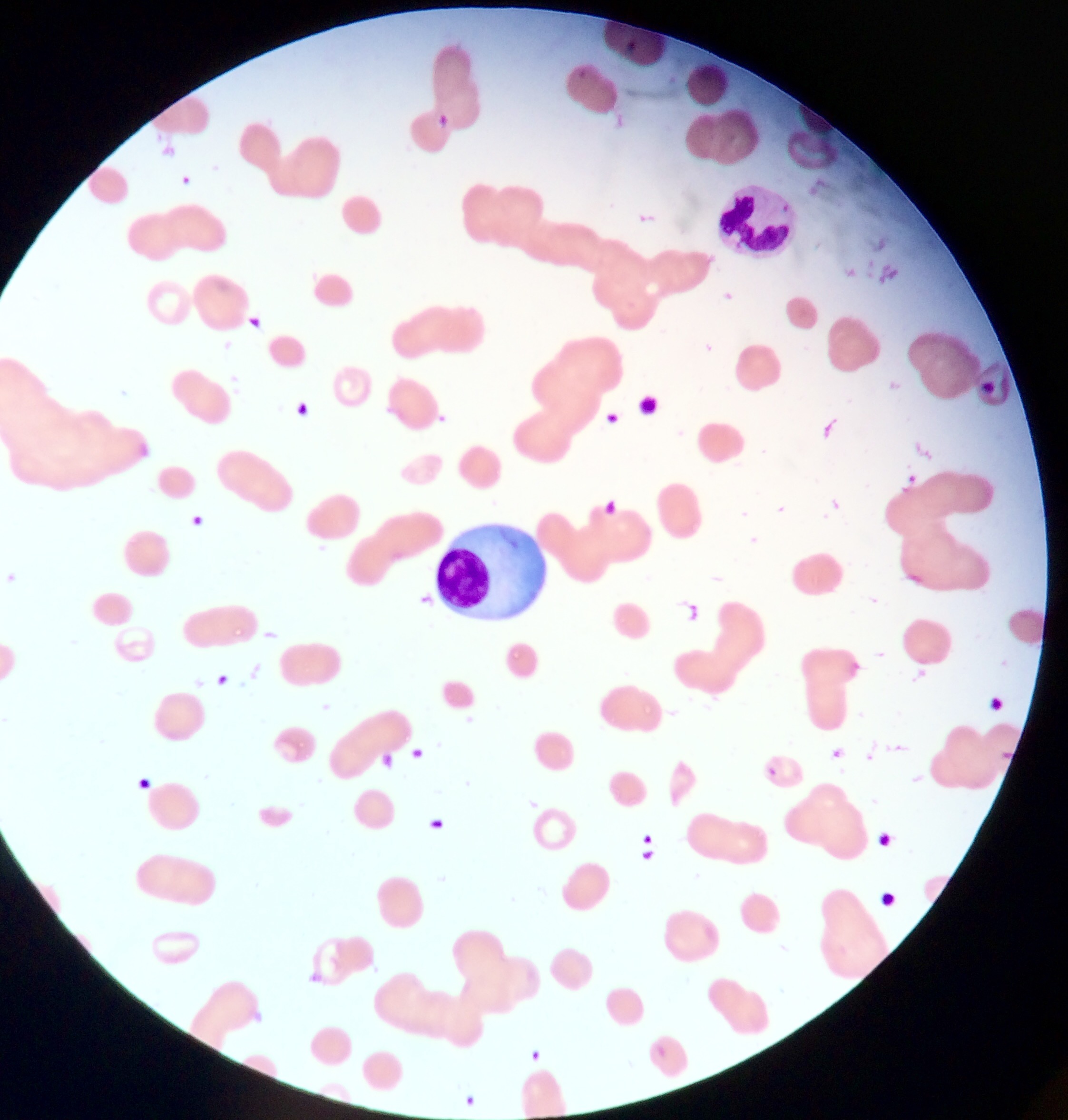 Hematology Spotter Slide