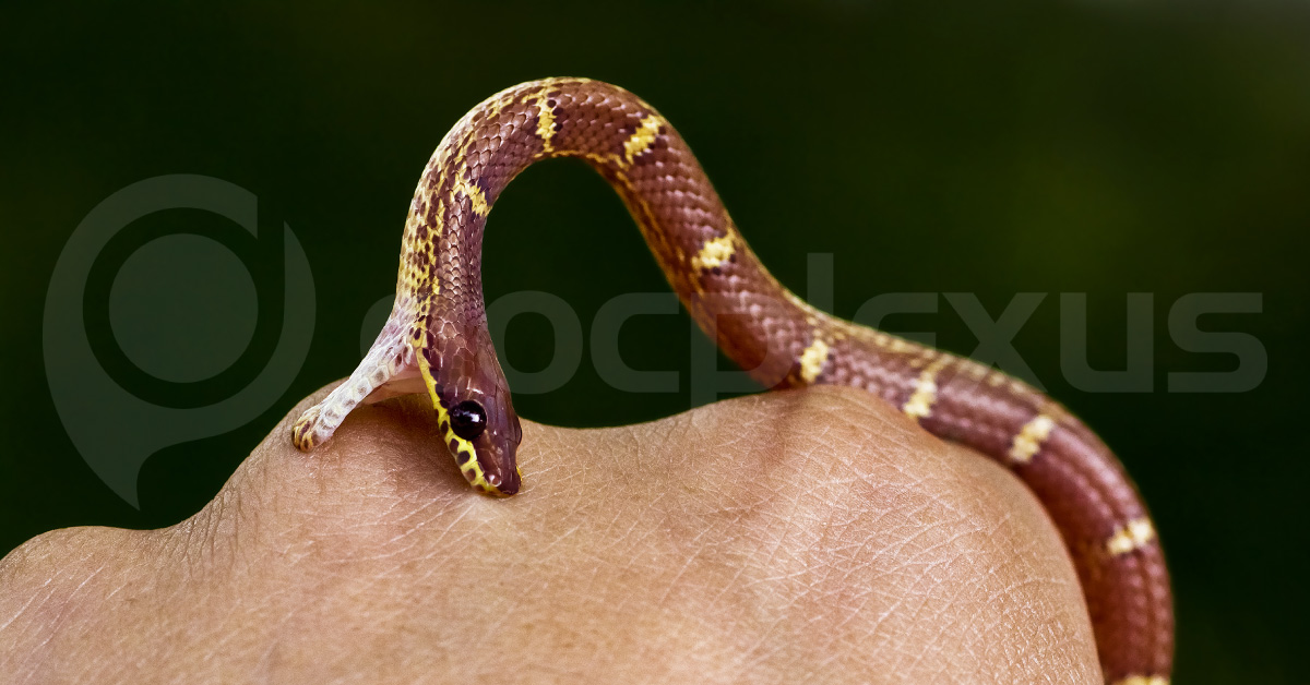 Emergency Management Of Snakebite In Indian Scenario