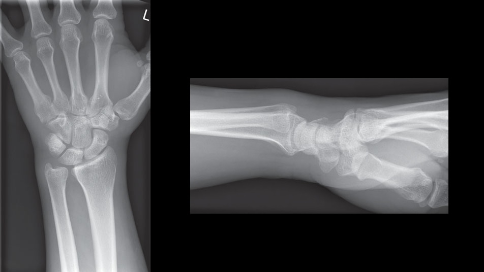 Diagnose The Condition In The Wrist