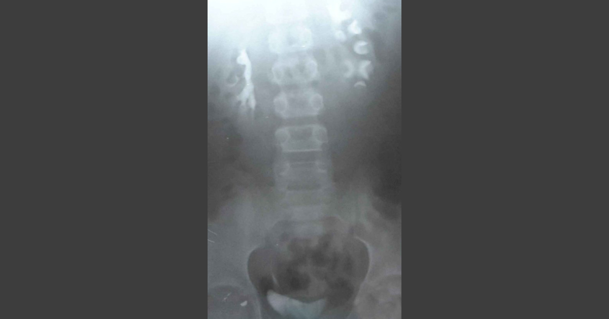 Interpret These Radiologic Findings
