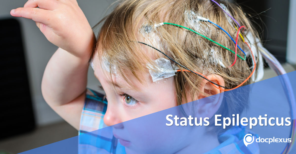 Pediatric Guide To Manage Status Epilepticus