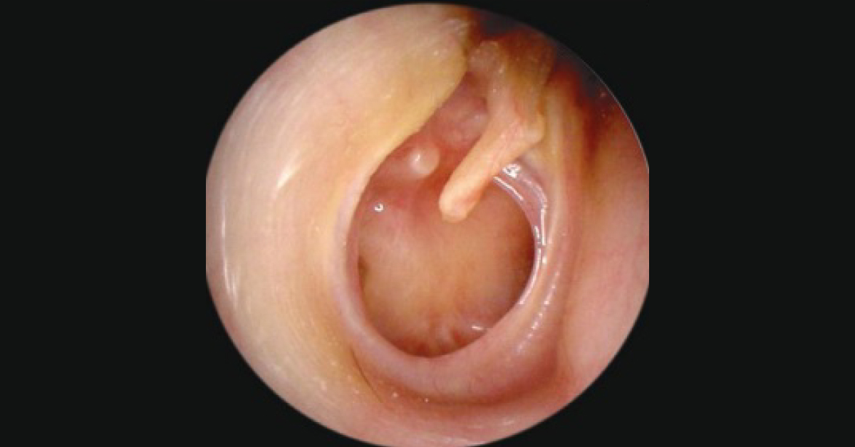 Diagnose This ENT Condition