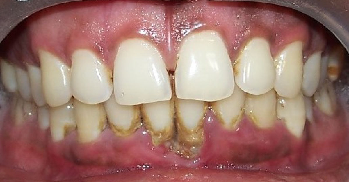 Spot The Diagnosis From Image