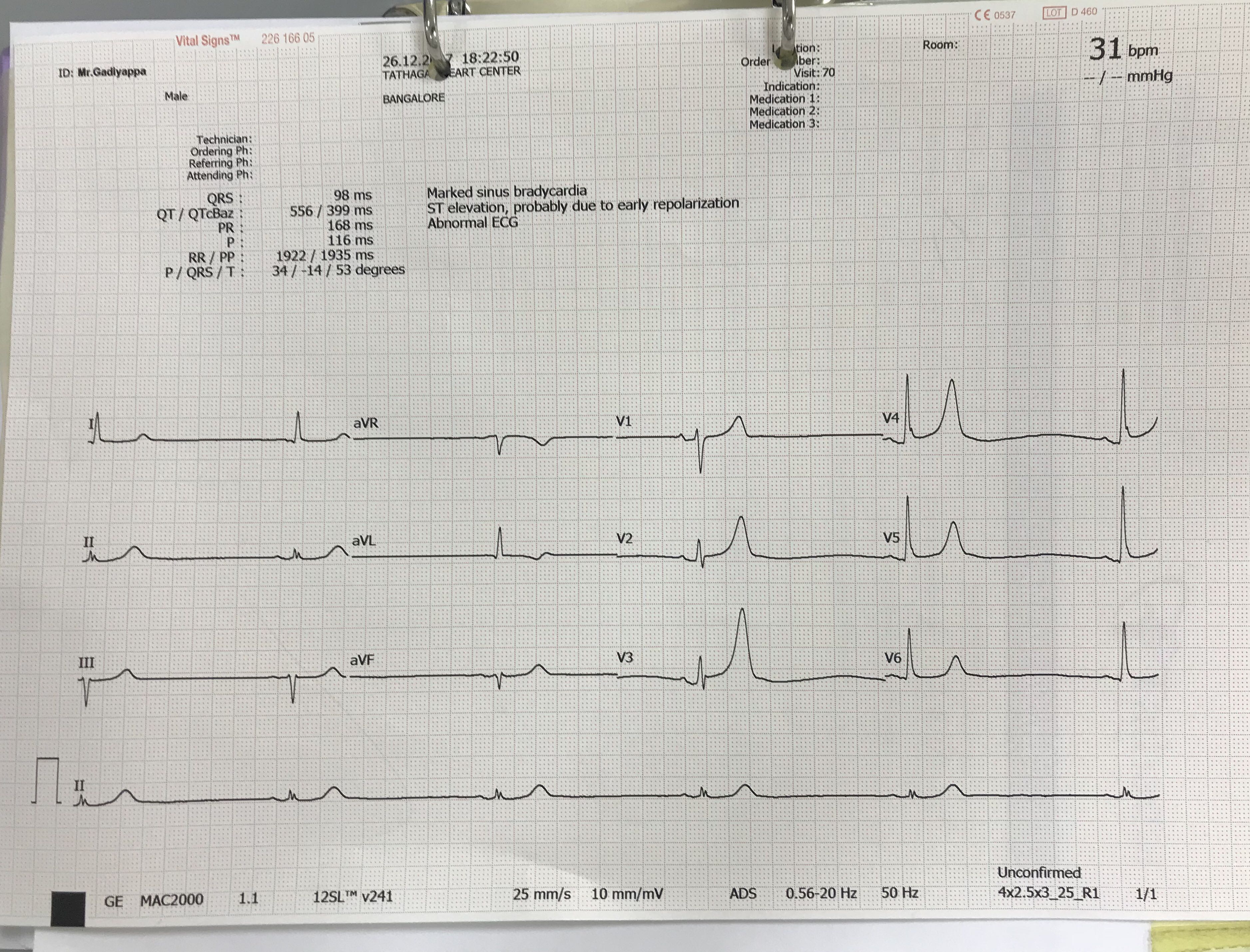 Case Of Bradycardia In 73 Year Old
