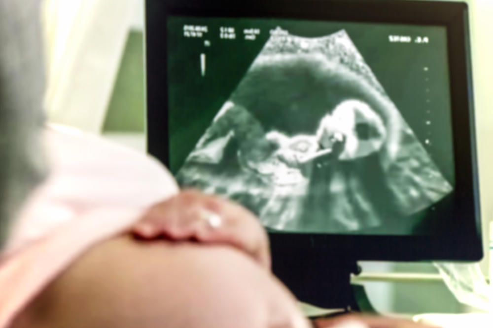 Who Is Responsible For The Wrong Diagnosis And Negligence Gynaecologist Or Radiologist?