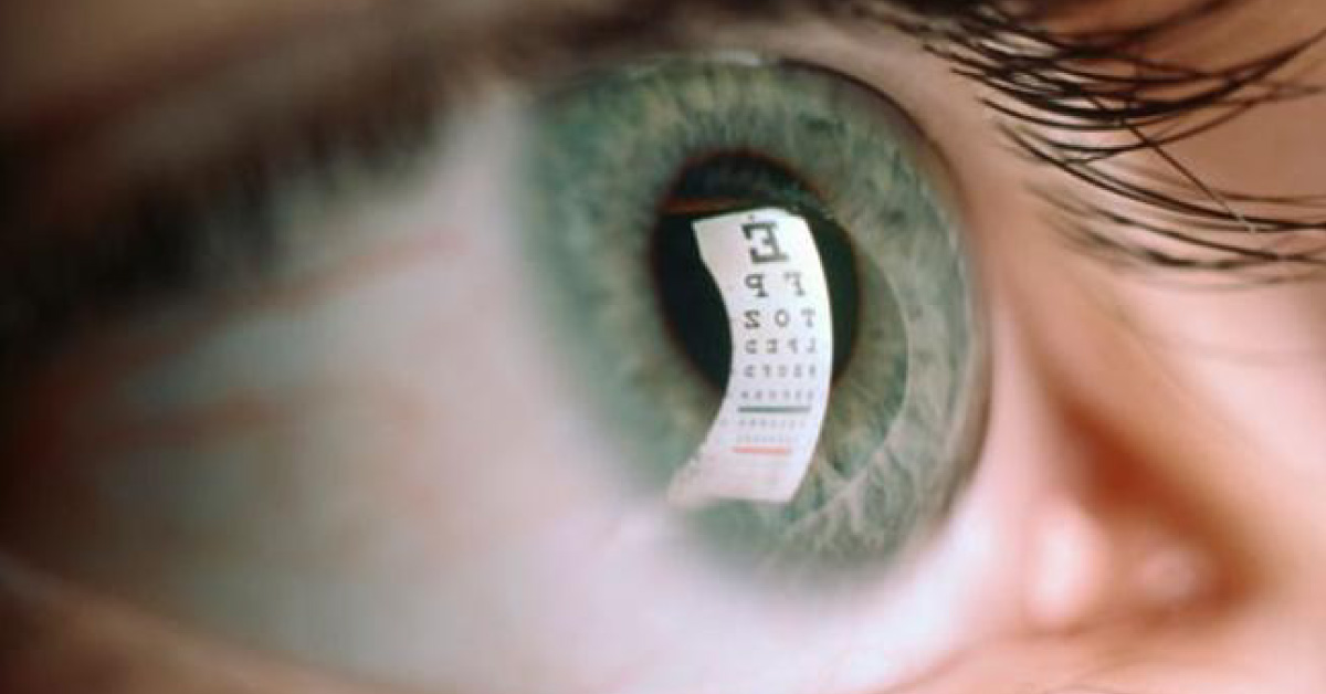 Brief Review Of Irritable Bowel Syndrome And Ocular Manifestations