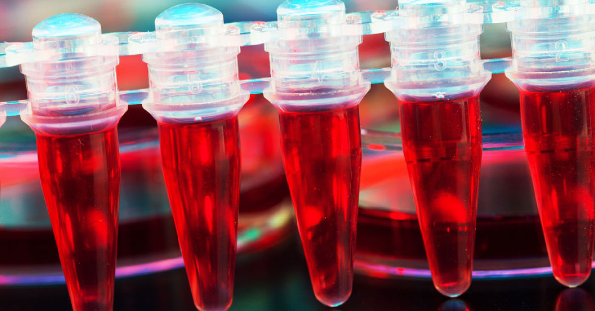 Stem Cell Transplantation