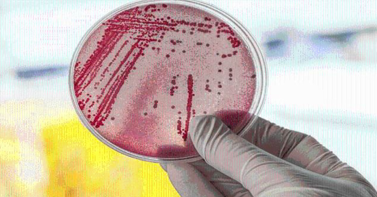 Superbug Spread Is Linked To Intake Of Sugar