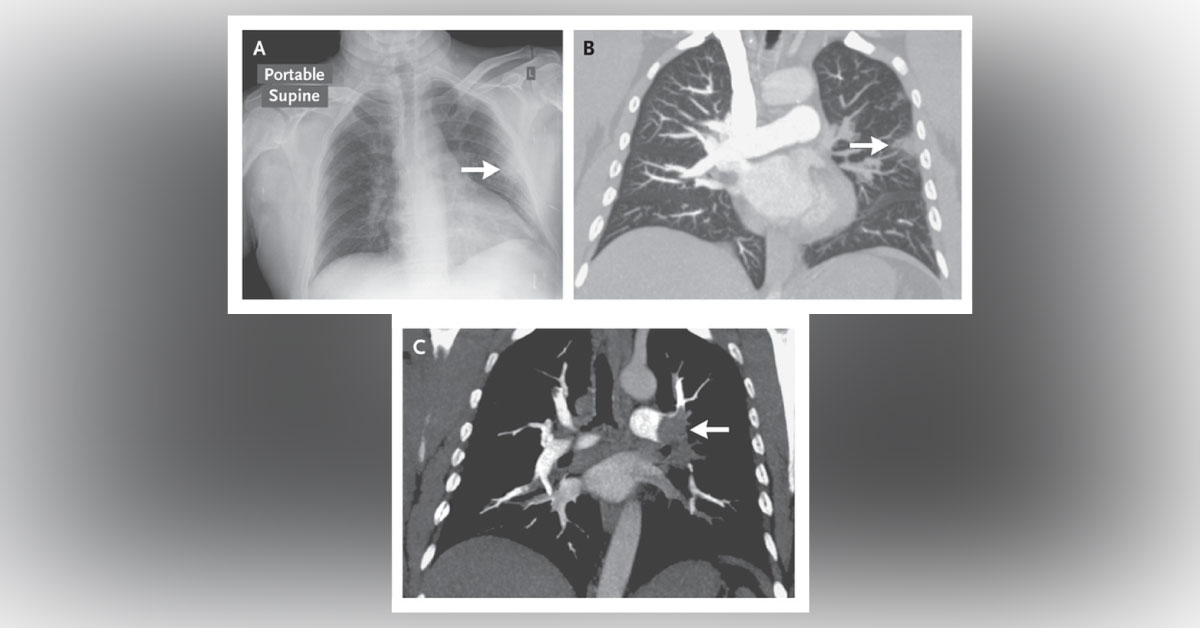 Identify This Condition