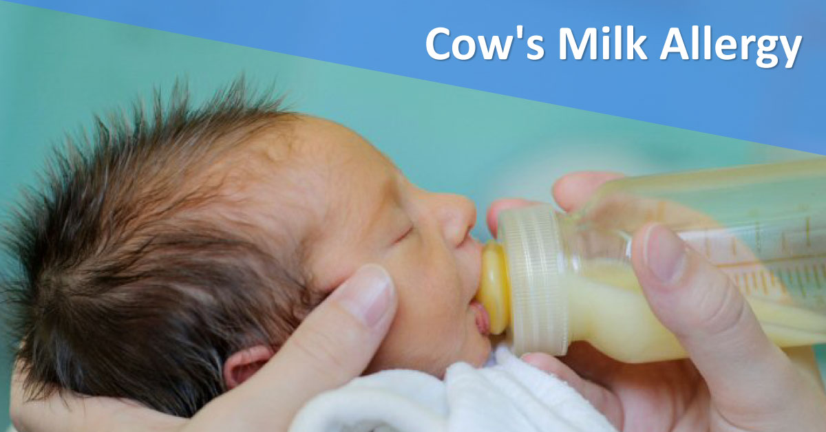 Cow’s Milk Protein Allergy, Management Guidelines: British Society for Allergy & Clinical Immunology