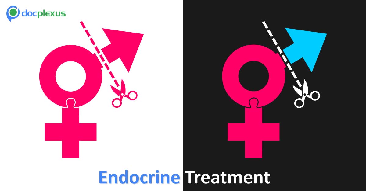 Endocrine Treatment Of Transsexual Persons: Clinical Practice Guideline