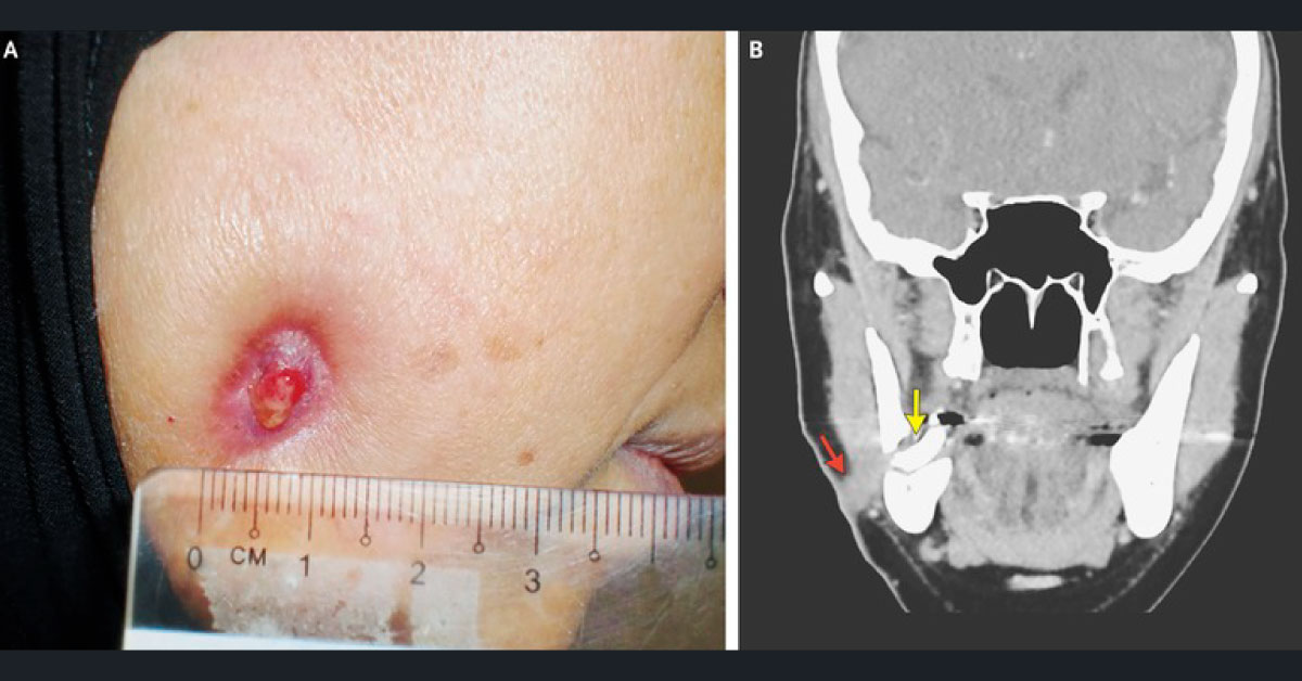 Identify This Condition And Suggest Management