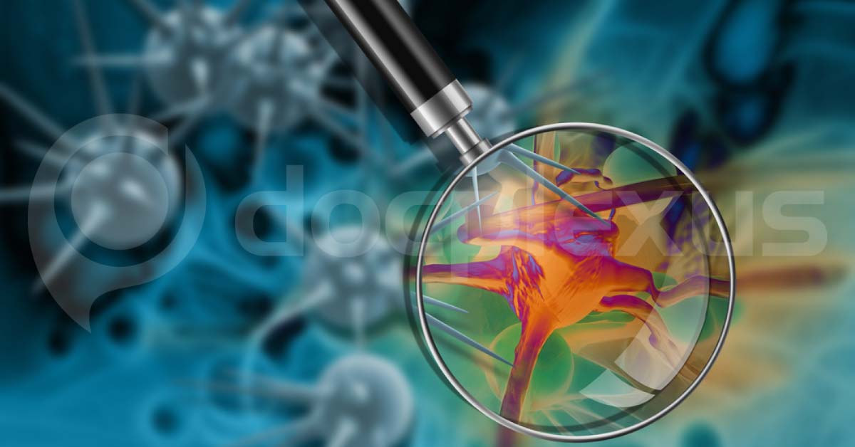 Nanoparticles To Help Surgeons In Killing Hidden Cancer Cells