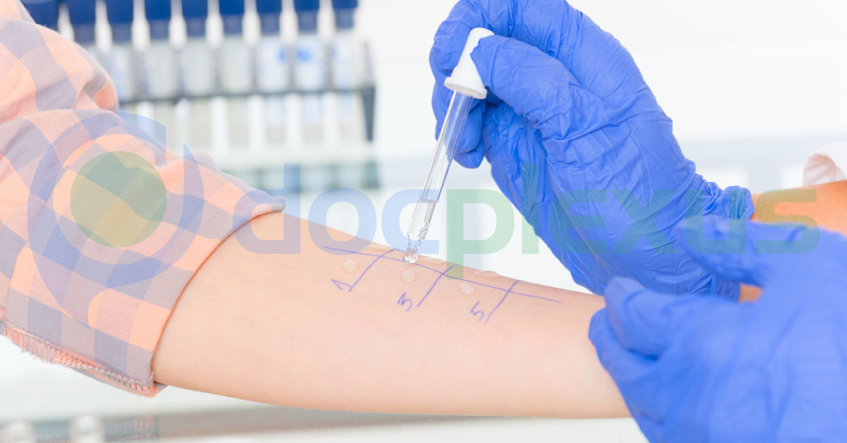 Self Proclaimed Allergies By Patients
