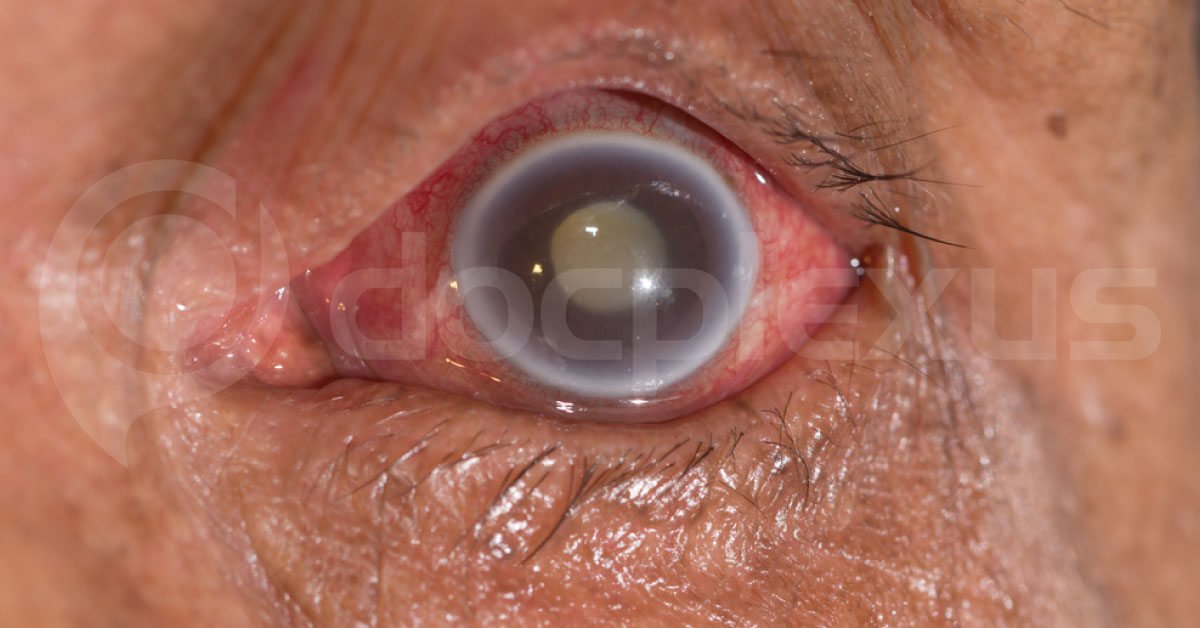 Spot The Diagnosis