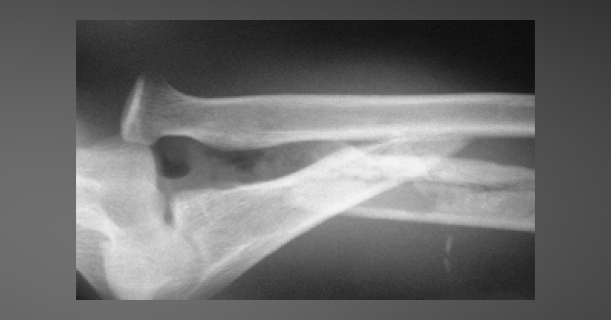 How Will You Describe This Condition?