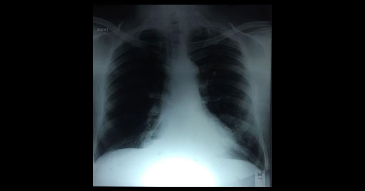 What Is This Rib Like Structure ?