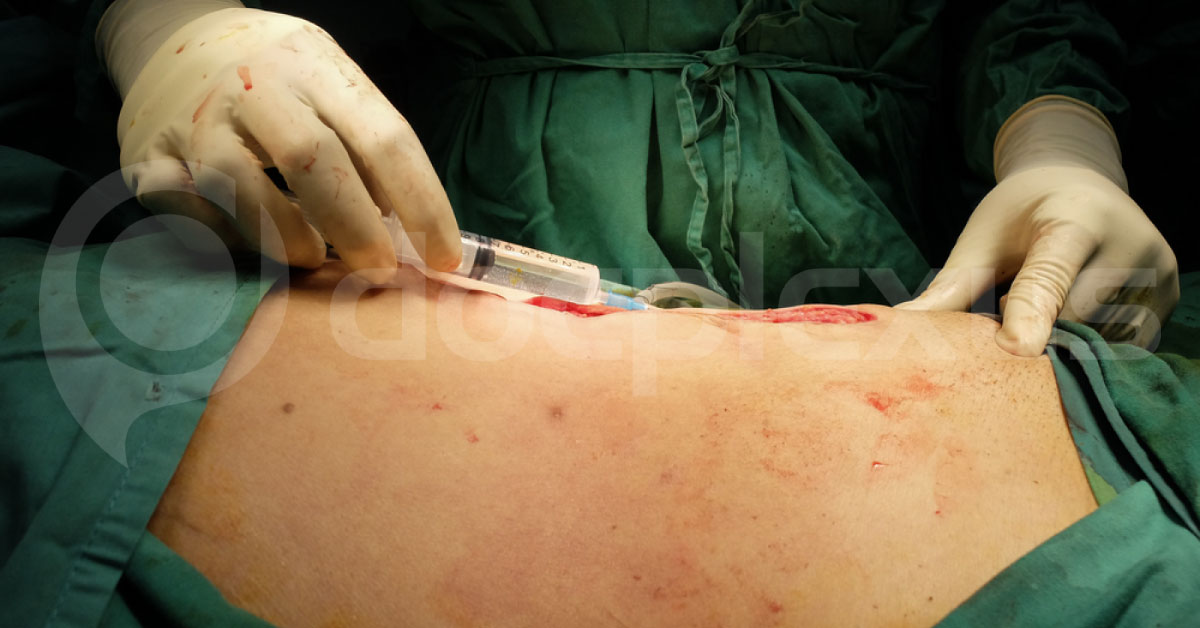 Hypothermia And Anaesthesia