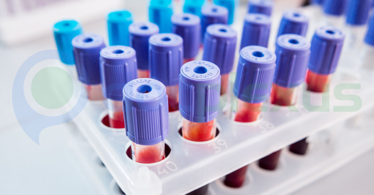 New Method Of Detecting Cholesterol In Blood, Fasting Not Required