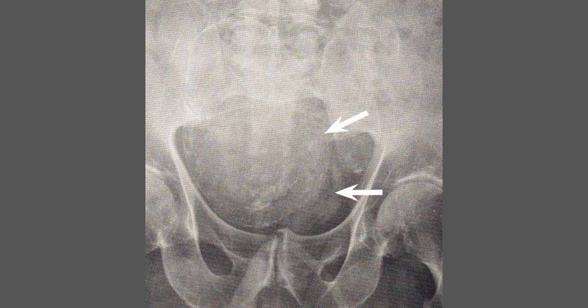How Will You Manage This Patient?