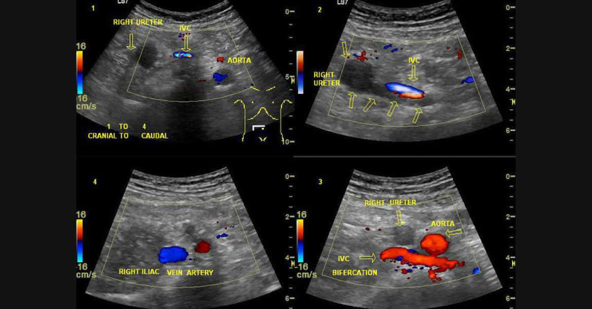 Identify the Underlying Condition of Groin Pain