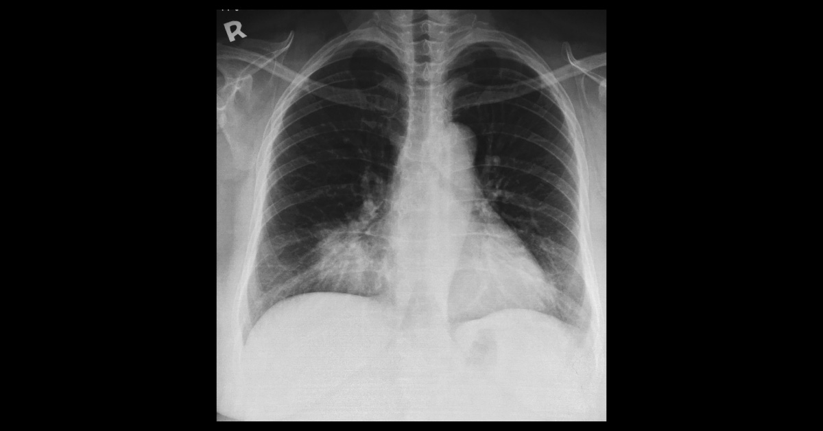 Female With Shortness Of Breath