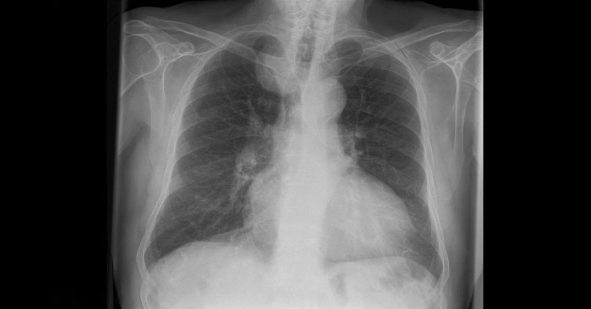 Interpret These Radiologic Findings