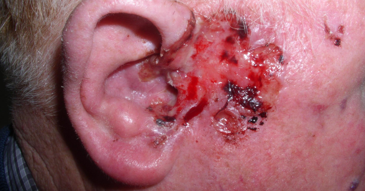 Diagnose This Patient's Condition