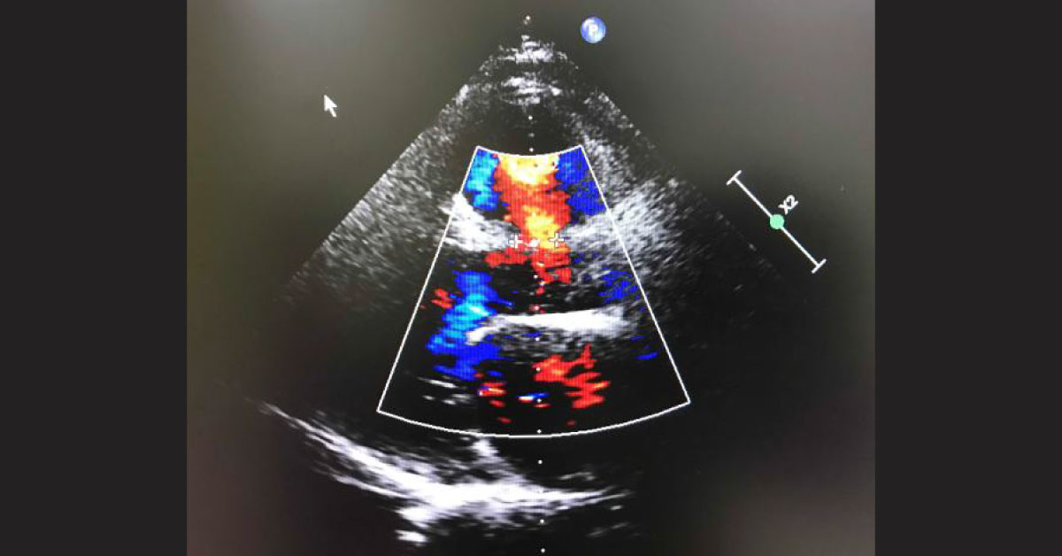 45 Years Male Smoker Presented With Breathlessness Cough Wheeze 